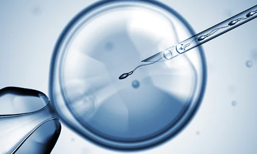 Intra-Cytoplasmic Sperm Injection (ICSI) Treatment in Ghaziabad